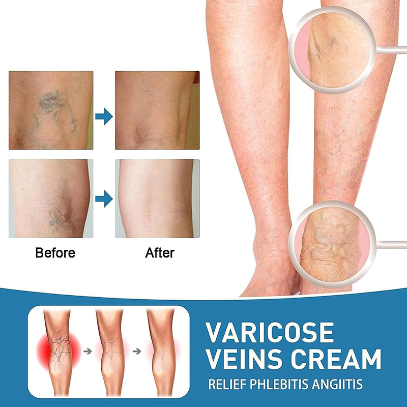 VeinVitalize™ - Venenbehandlungscreme