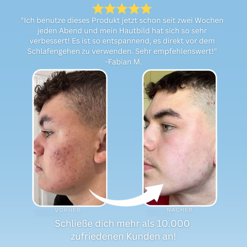 SkinGenie™ - Schönheitswerkzeug