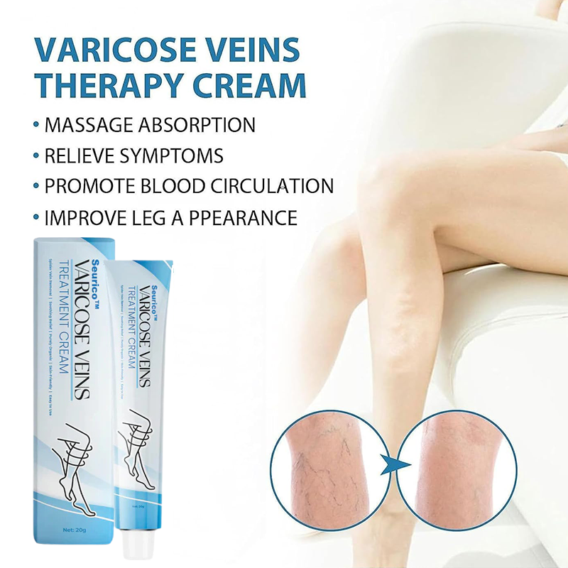 VeinVitalize™ - Venenbehandlungscreme