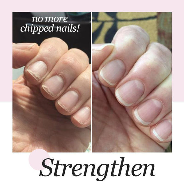 Nagelreparaturgel