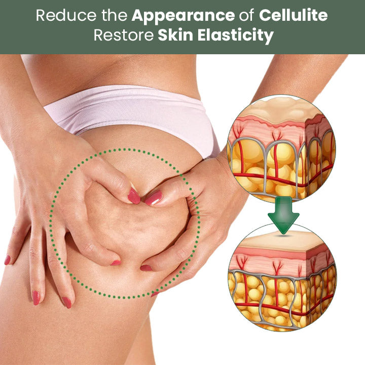 Oveallgo™ Wormwood CelluliteBeGone Hautstraffungscreme