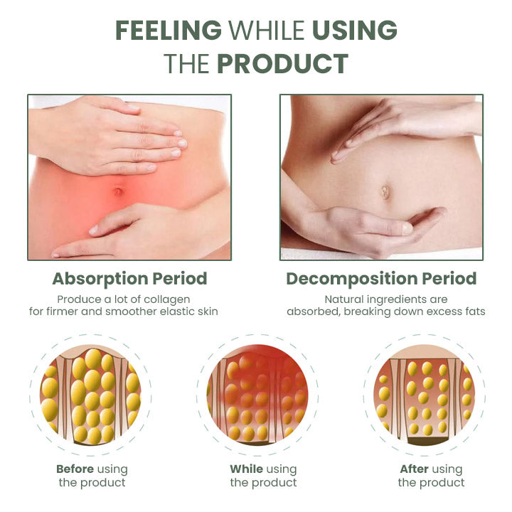 Oveallgo™ Wormwood CelluliteBeGone Hautstraffungscreme
