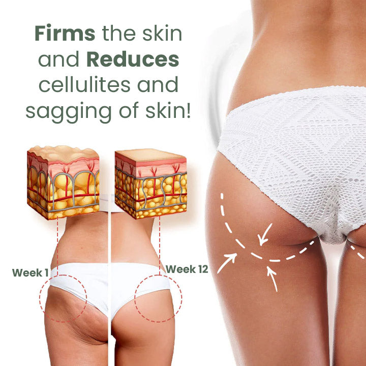 Oveallgo™ Wormwood CelluliteBeGone Hautstraffungscreme