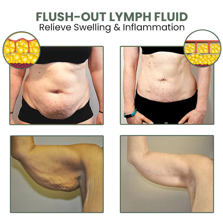 Oveallgo™ Wormwood CelluliteBeGone Hautstraffungscreme